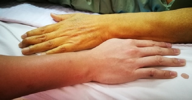 Acute diseases cannot be treated at home or by phone