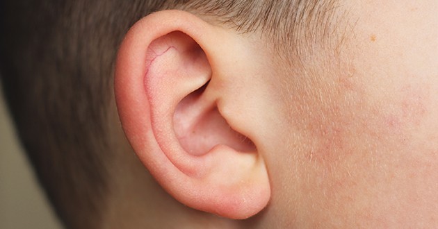 Microtia
