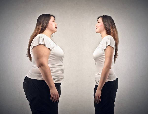 Bariatric surgery procedures Atlas hospital Bariatric surgery procedures Atlas hospital