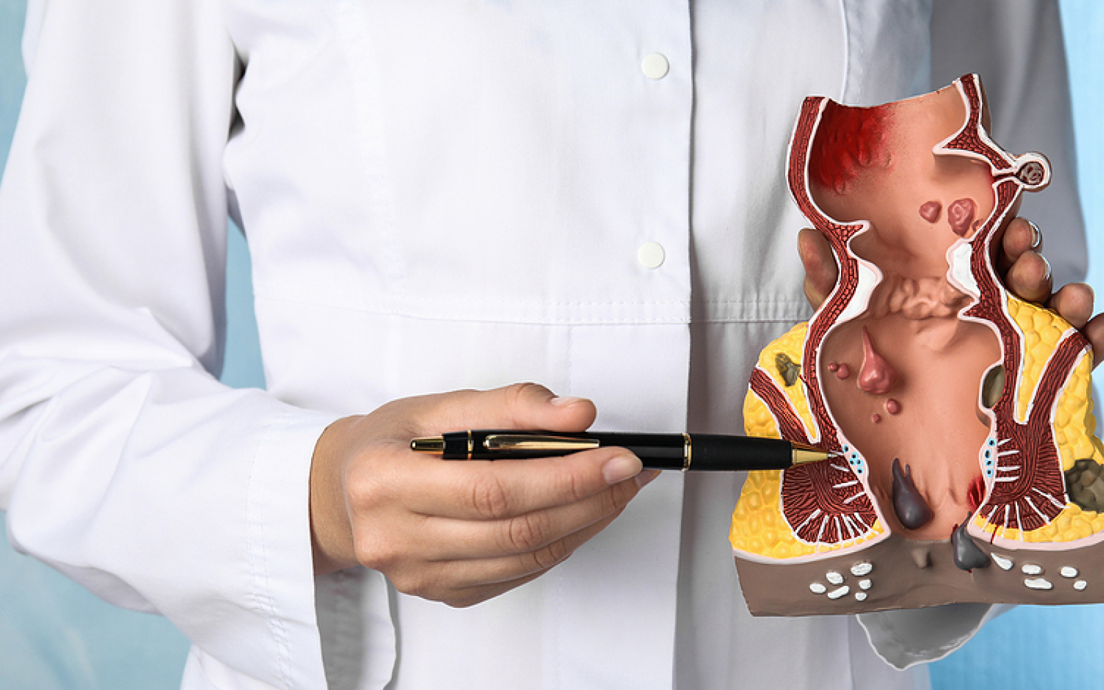Hemorrhoids: Causes, Symptoms, and Modern Treatment Methods