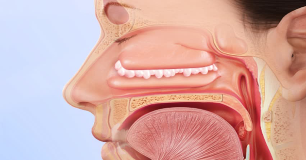 Nasal polyps – symptoms, diagnosis and treatment