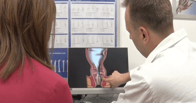 THD Doppler Method for hemorrhoids treatment with Dr Nemanja Zarić