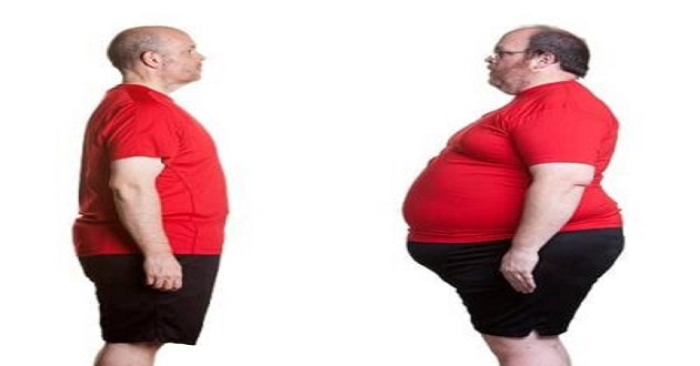 Bariatric Surgery and Long-term Durability of Weight Loss