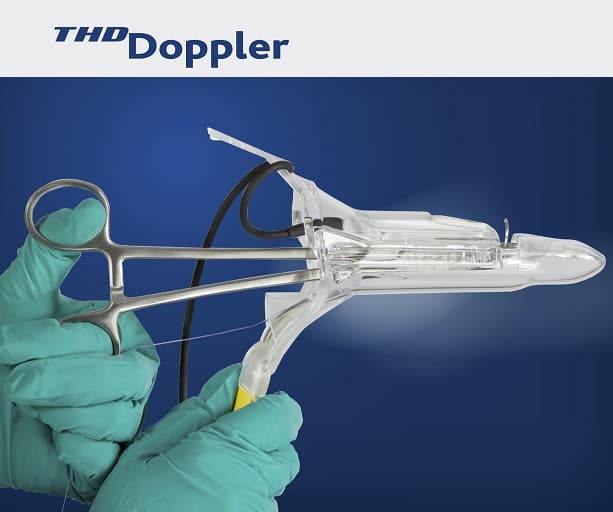 thd doppler hemorrhoid surgery thd doppler hemorrhoid surgery