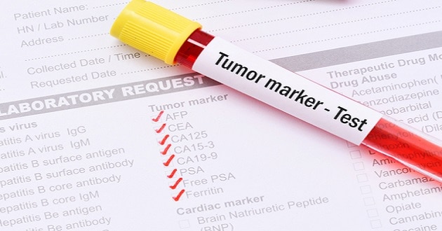 Nano tehnologija donosi preko 30 novih tumor i bio markera
