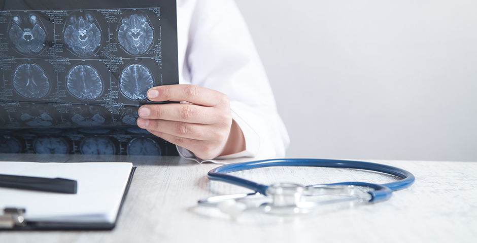 lice Neurološki pregled